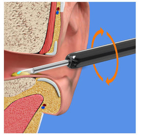 Earwax Remover Kit